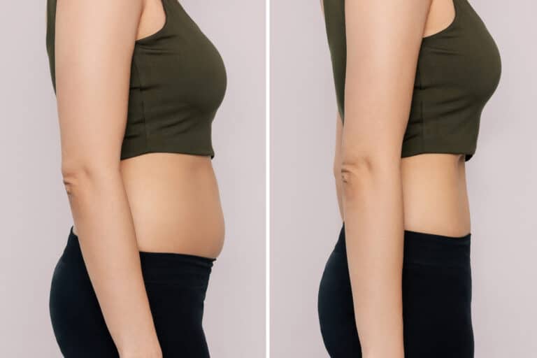 A woman with belly with excess fat and toned slim stomach with abs before and after losing weight